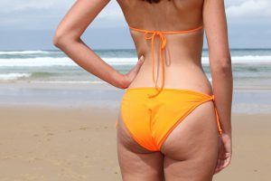 A woman with cellulite on the beach, wearing bikini