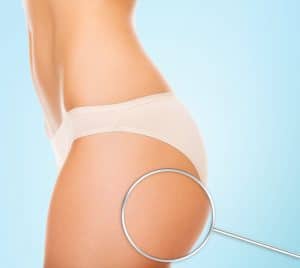 health, people, bodycare and beauty concept - close up of woman buttocks and magnifier over blue background