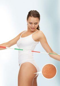 picture of woman with measuring tape looking at her cellulite