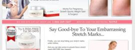 skinception stretch mark cream