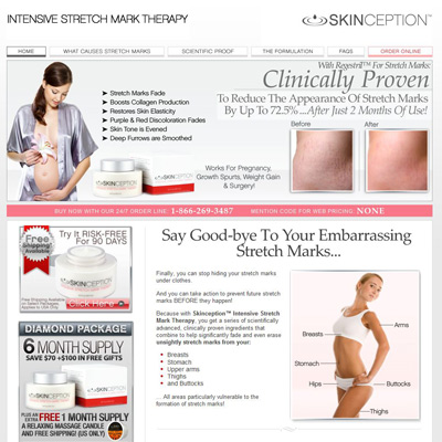 skinception stretch mark cream