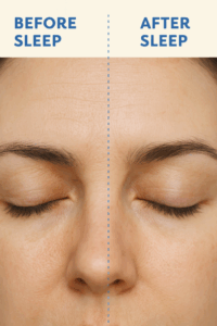 skin before and after sleep