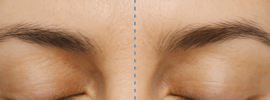 skin before and after sleep